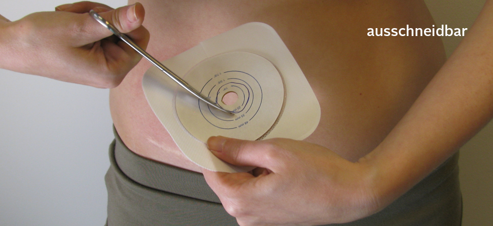 ConvaTec Esteem Synergy Versorgungswechsel Schritt f&uuml;r Schritt 02