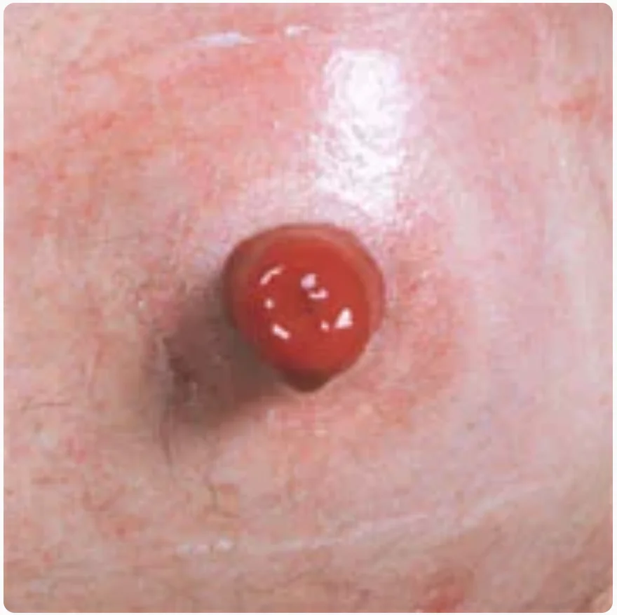 eine nahaufnahme der haut einer person mit einem roten kreis