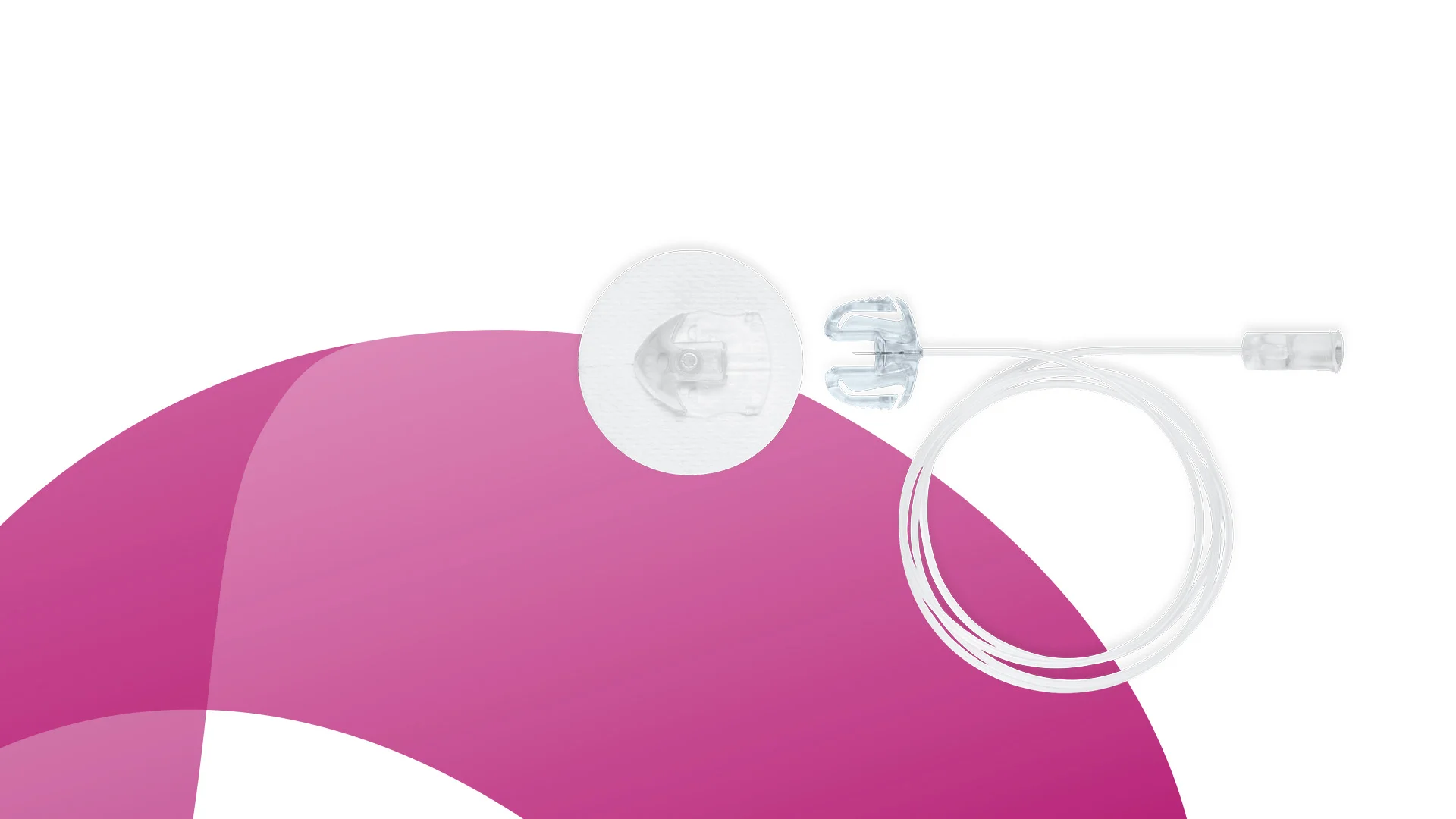 An image showing an infusion set.