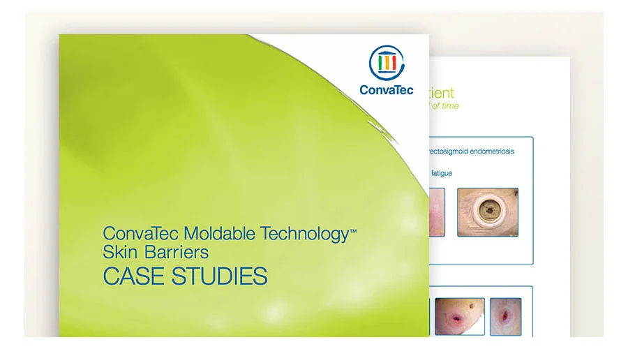 grafisk brugergrænseflade