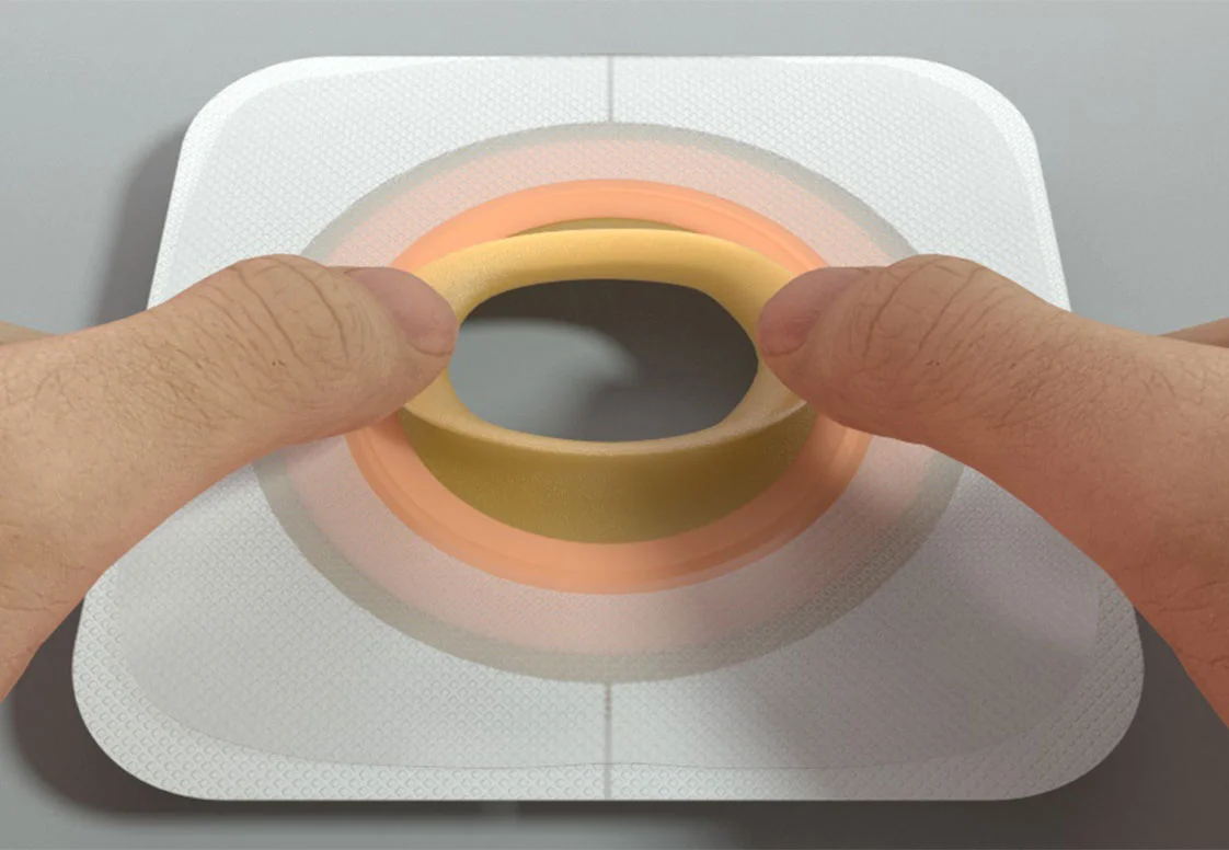 Image of Moldable Technology™ Skin Barriers ostomy product 