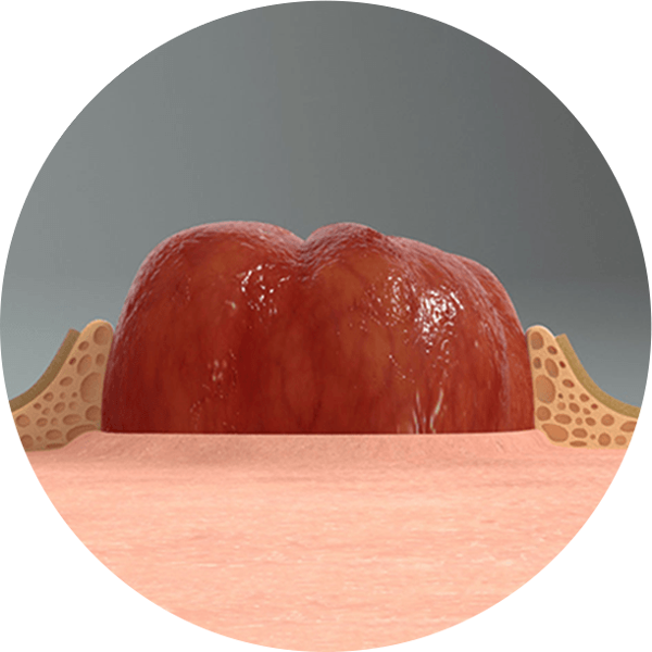 et nærbilde av LEAK-LOCK-systemet™