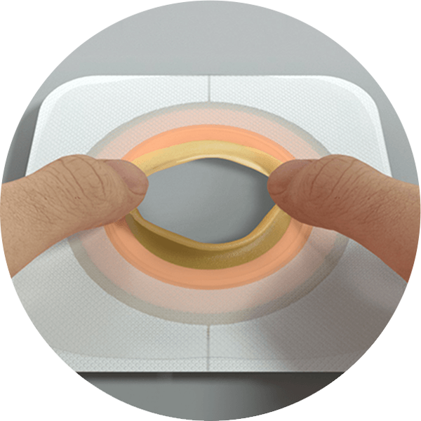 Et nærbilde av en hudplate