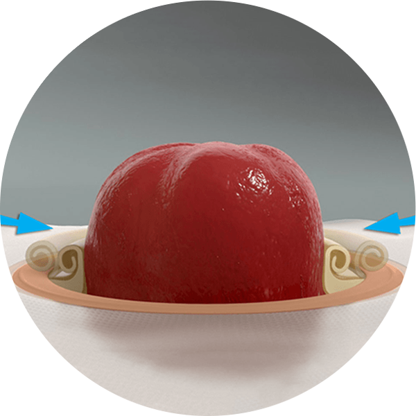 et nærbilde av en formbar hudplate